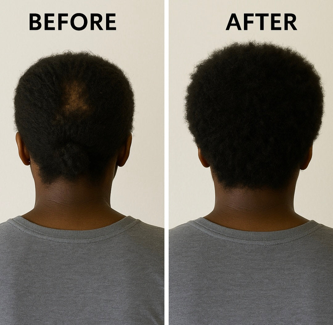 Hair Growth & Scalp Repair Oil- With Ayurvedic Herbs (2oz/60ml)